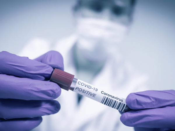 थप ८ हजार ८५० जनामा कोरोना संक्रमण पुष्टि 