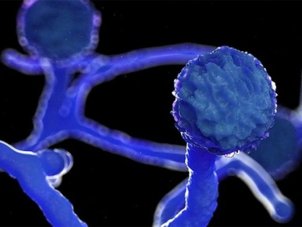 कोरोना संक्रमणमुक्त भएकाहरुमा ‘ब्ल्याक फङ्गस’को संक्रमण पुष्टि